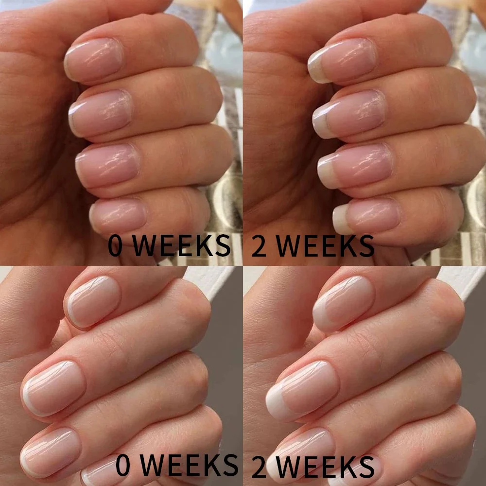 AMORIE - Nail Growth Oil for Strength and Moisture - Image 2